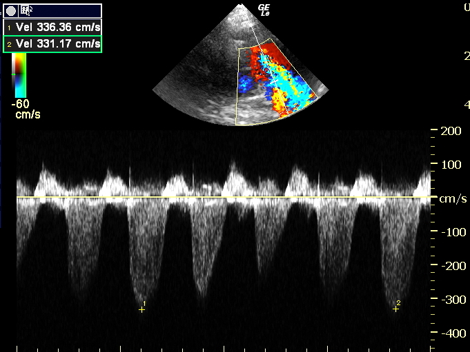 Pulmonary arterial hypertension in a cat with left- and right-sided ...