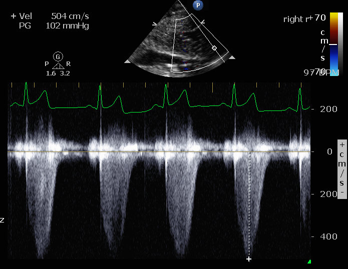 Pulmonary thromboembolism in a dog – Vet Practice Support