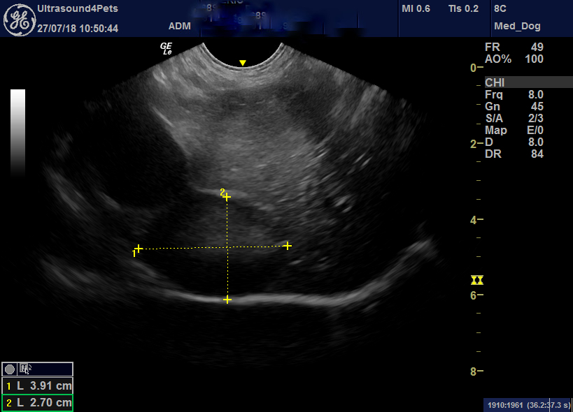 Persistent cutaneous flushing associated with presumed renal neoplasia ...