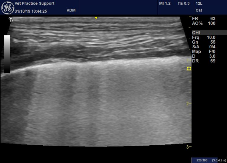 Lung Ultrasound: Contusions, Interstitial Syndrome, A, B, C, E, I And Z ...