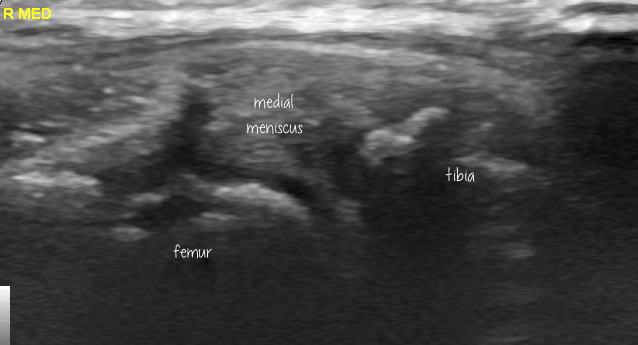 Meniscal Extrusion In Dogs: The Sonographic Perspective – Vet Practice 