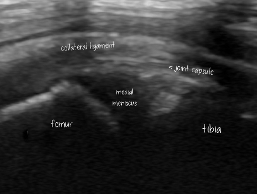 Meniscal extrusion in dogs: the sonographic perspective – Vet Practice ...